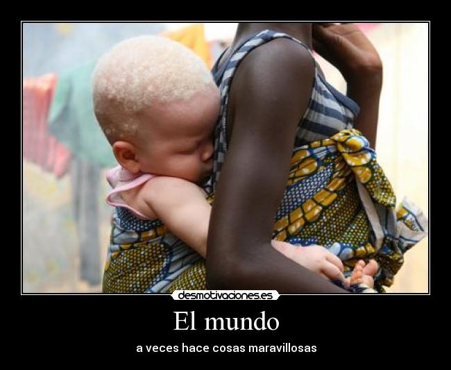 El mundo - a veces hace cosas maravillosas