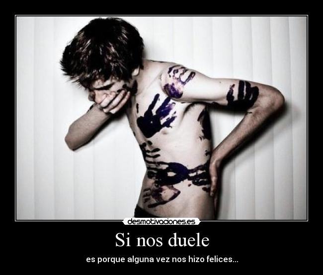 Si nos duele - 