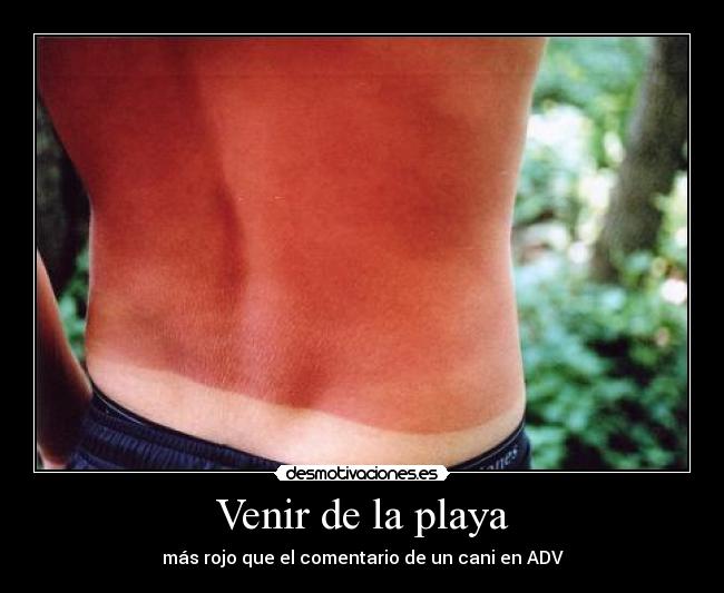 carteles quemado playa sol cani adv desmotivaciones