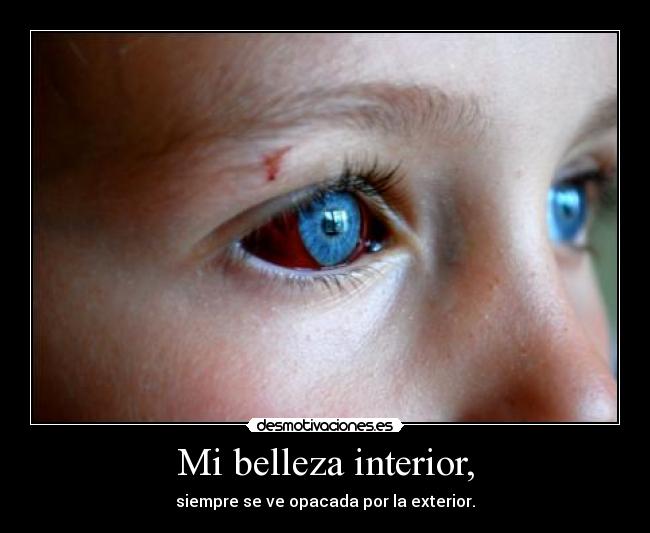 Mi belleza interior, - siempre se ve opacada por la exterior.