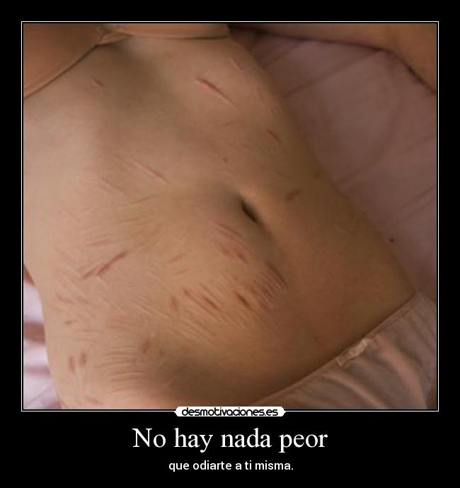 No hay nada peor - 