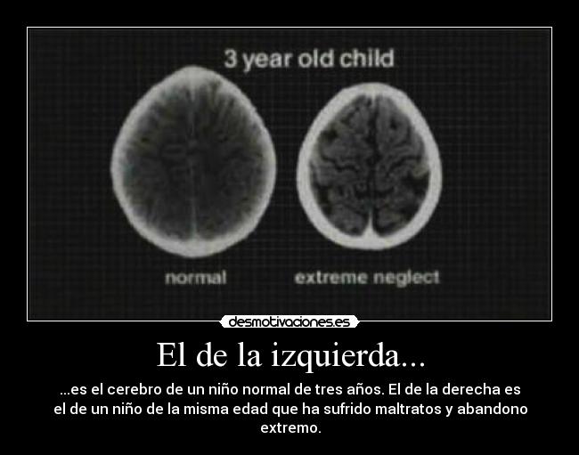 carteles maltrato ninos derechos infancia abandono desmotivaciones