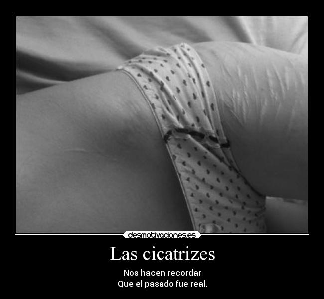 Las cicatrizes - Nos hacen recordar
Que el pasado fue real.