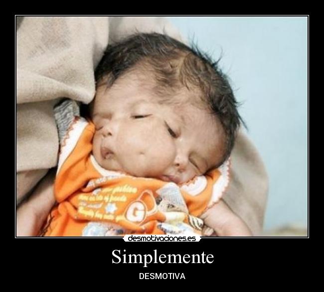 Simplemente -