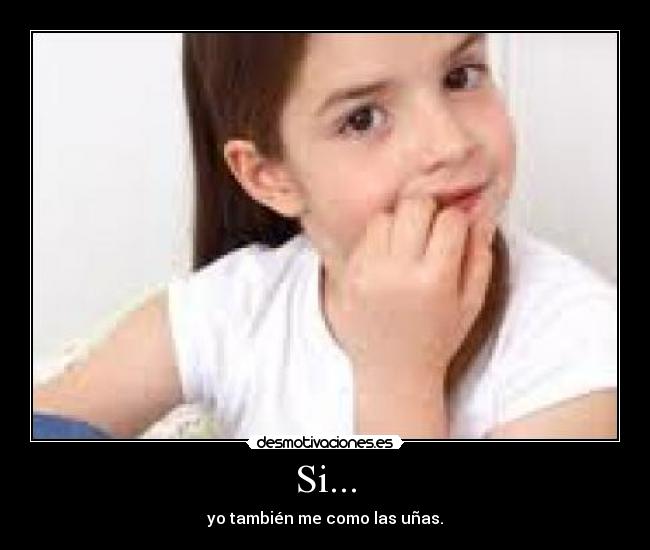 Si... - yo también me como las uñas.