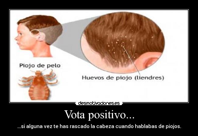 Vota positivo... -
