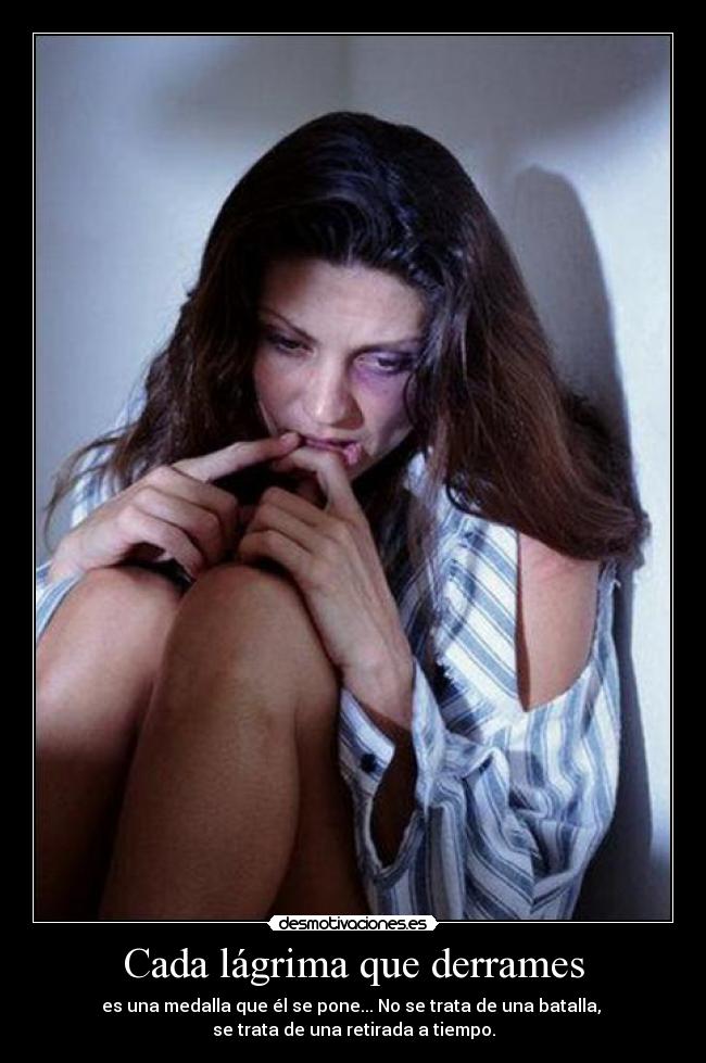 Cada lágrima que derrames - es una medalla que él se pone... No se trata de una batalla,
se trata de una retirada a tiempo.