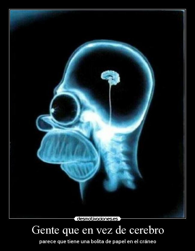 Gente que en vez de cerebro - 