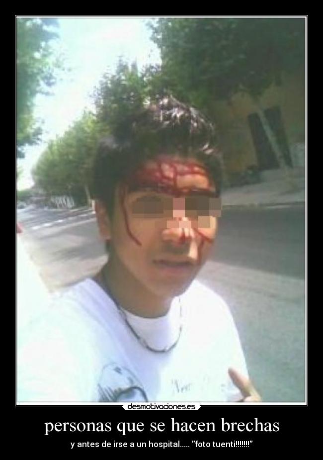 personas que se hacen brechas - y antes de irse a un hospital..... foto tuenti!!!!!!!
