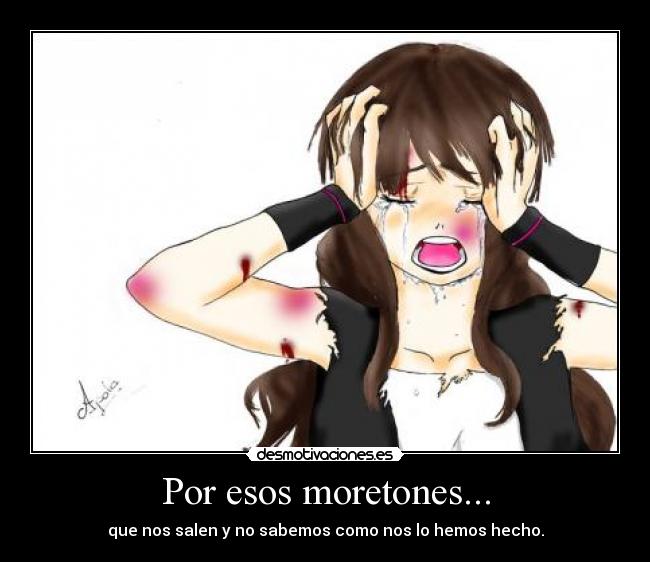 Por esos moretones... - que nos salen y no sabemos como nos lo hemos hecho.