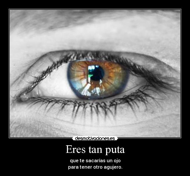 Eres tan puta - 