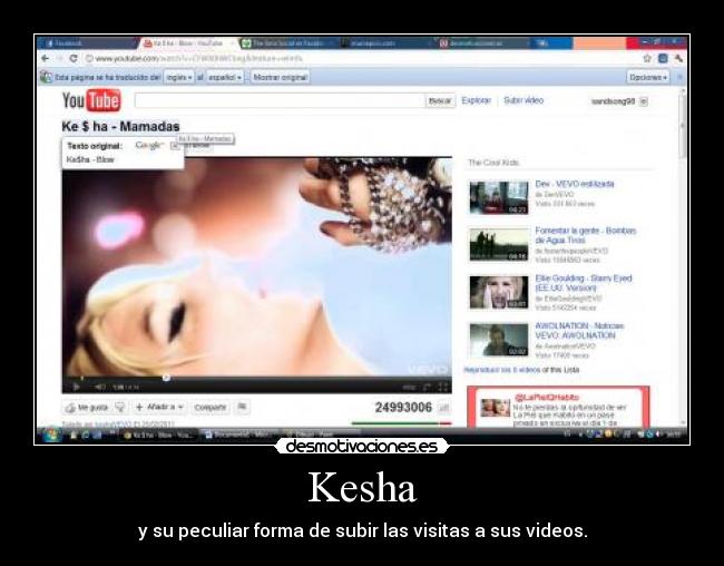 Kesha - y su peculiar forma de subir las visitas a sus videos.