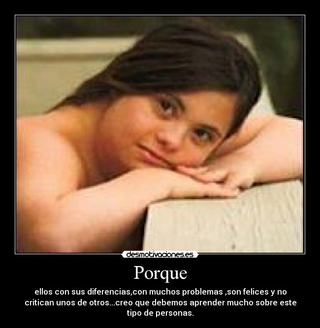 Porque - ellos con sus diferencias,con muchos problemas ,son felices y no
critican unos de otros...creo que debemos aprender mucho sobre este
tipo de personas.