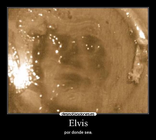 Elvis - por donde sea.