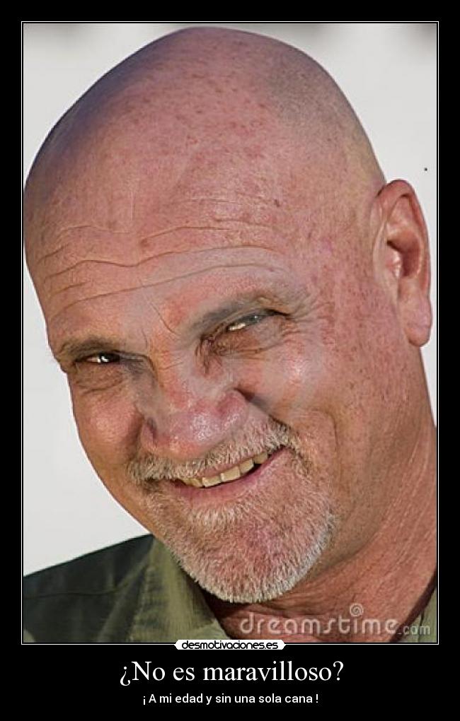 ¿No es maravilloso? - 