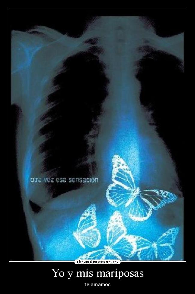 Yo y mis mariposas -