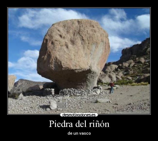 Piedra del riñón - de un vasco