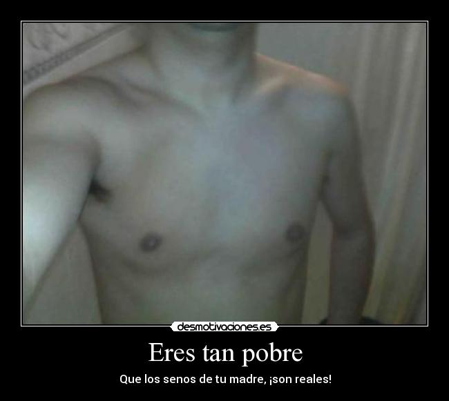 Eres tan pobre -
