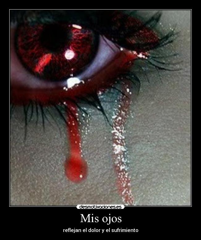 Mis ojos - reflejan el dolor y el sufrimiento