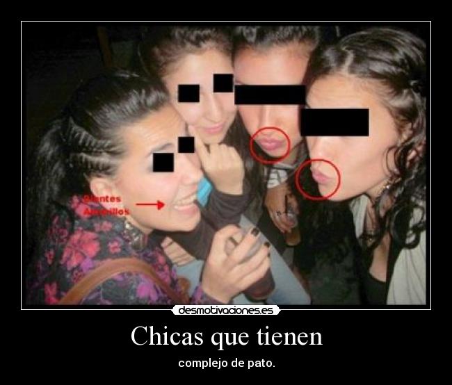 Chicas que tienen - complejo de pato.
