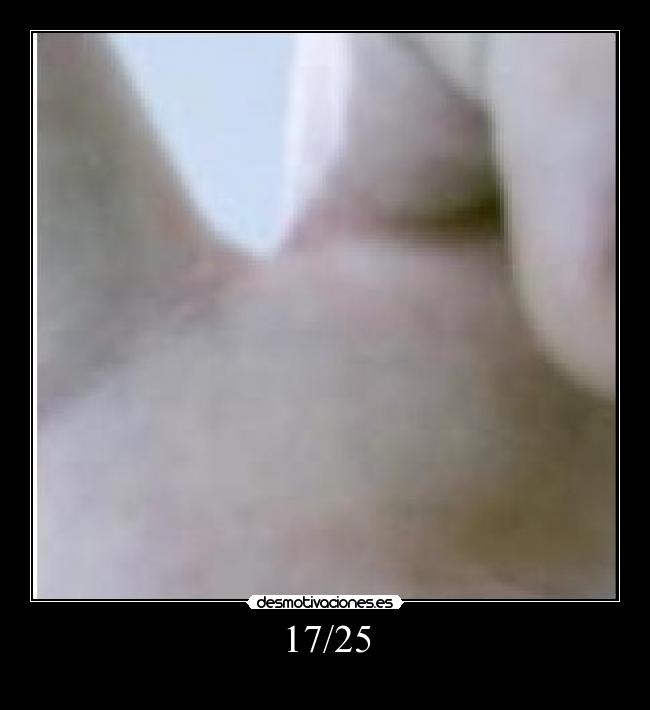 17/25 -