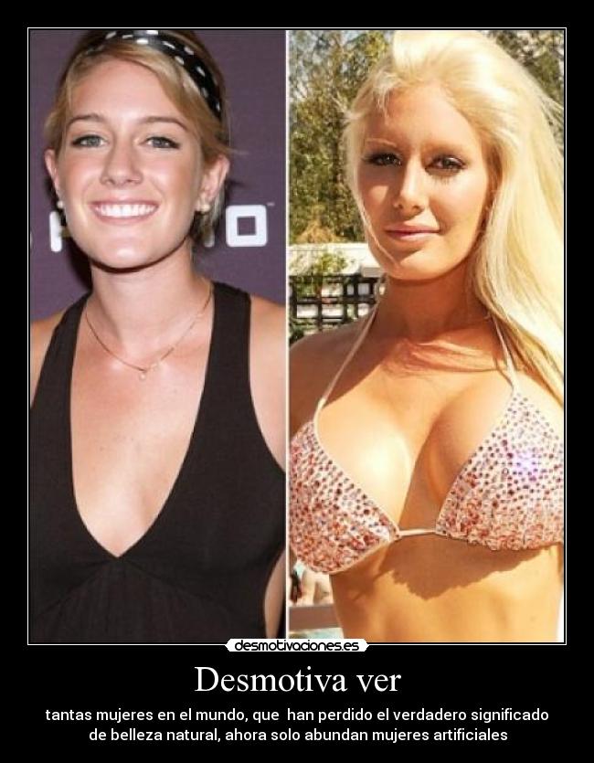 Desmotiva ver - tantas mujeres en el mundo, que han perdido el verdadero significado
de belleza natural, ahora solo abundan mujeres artificiales