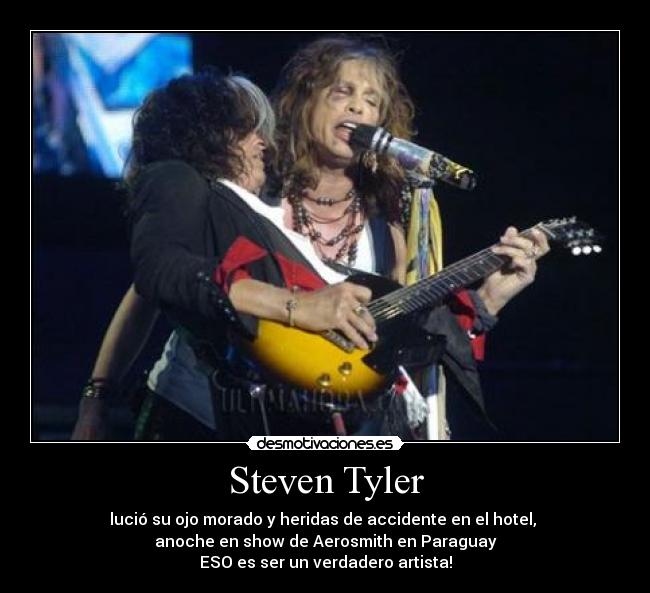 Steven Tyler - lució su ojo morado y heridas de accidente en el hotel, 
anoche en show de Aerosmith en Paraguay
ESO es ser un verdadero artista!