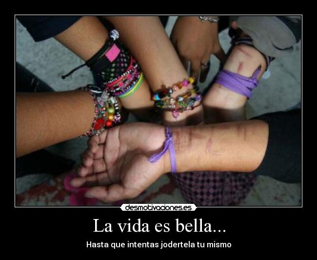 La vida es bella... - Hasta que intentas jodertela tu mismo