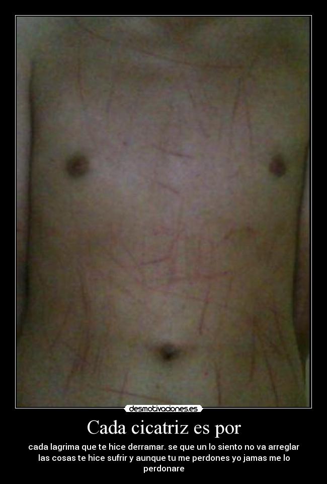 Cada cicatriz es por - 