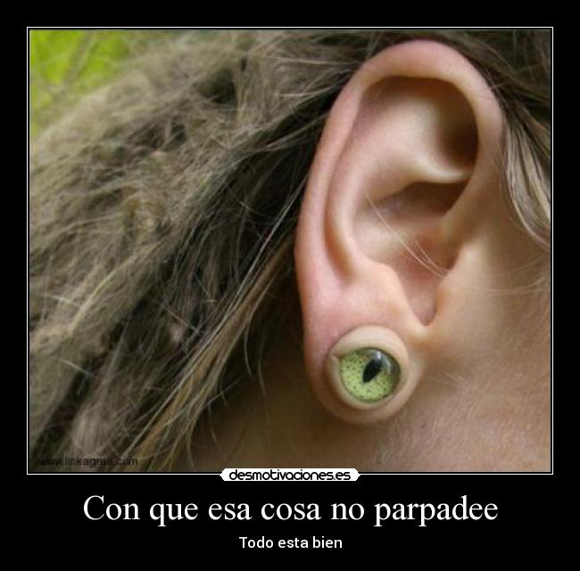 Con que esa cosa no parpadee -