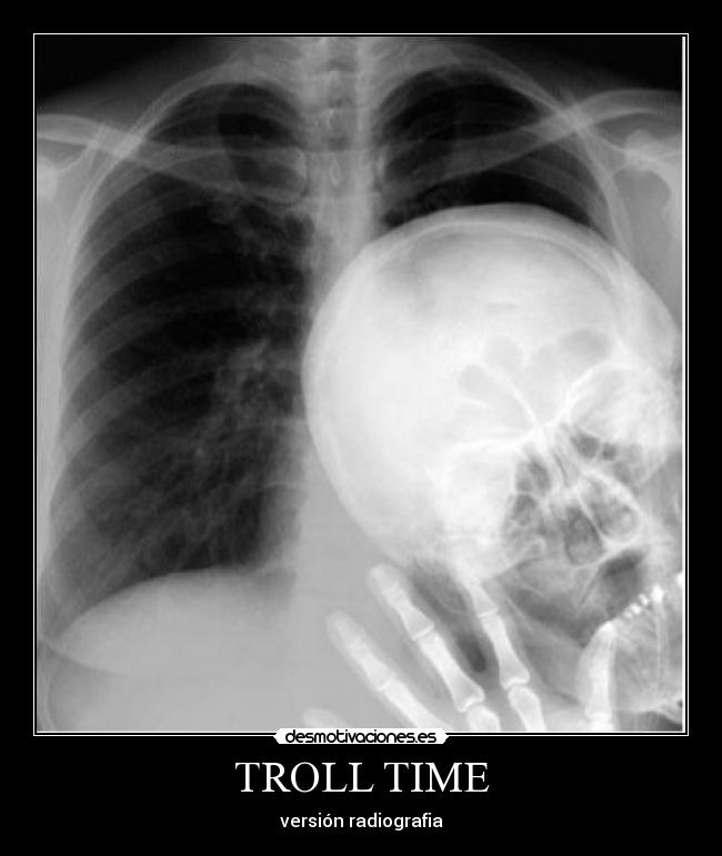 TROLL TIME - versión radiografia