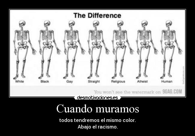 Cuando muramos - todos tendremos el mismo color.
Abajo el racismo.