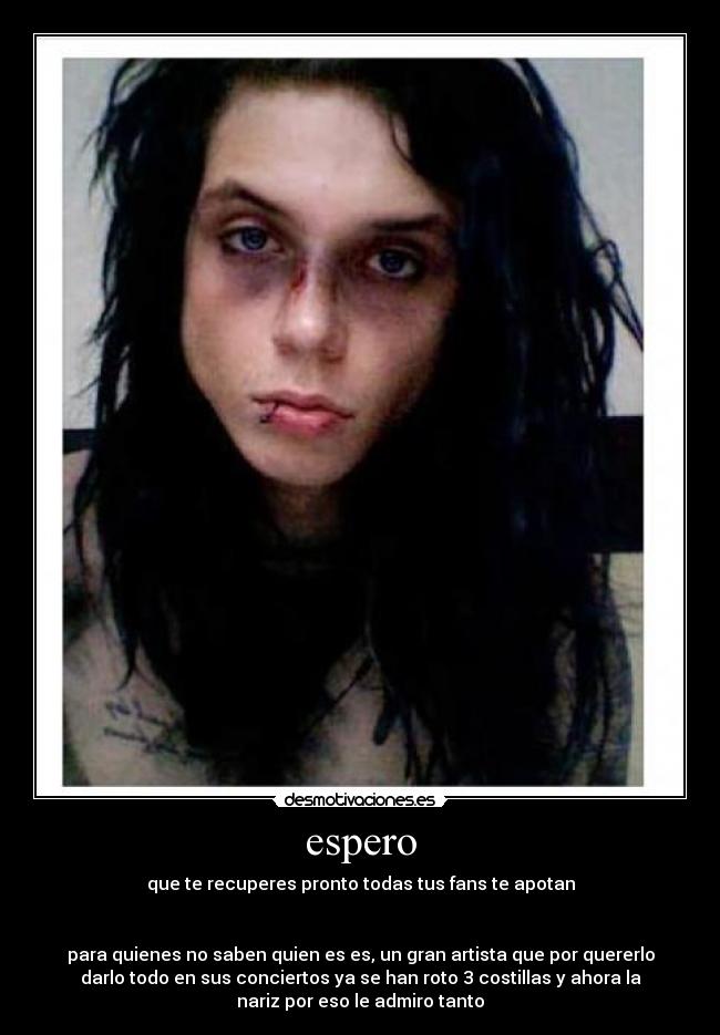 espero - que te recuperes pronto todas tus fans te apotan


para quienes no saben quien es es, un gran artista que por quererlo
darlo todo en sus conciertos ya se han roto 3 costillas y ahora la
nariz por eso le admiro tanto