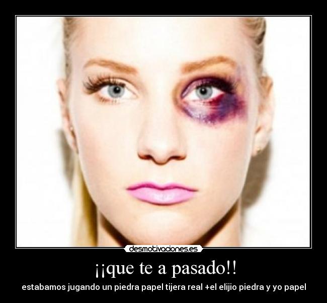 ¡¡que te a pasado!! - estabamos jugando un piedra papel tijera real +el elijio piedra y yo papel