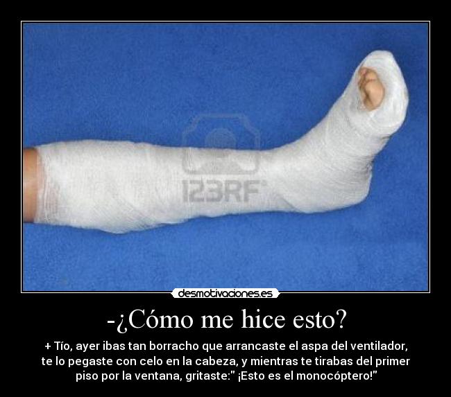 -¿Cómo me hice esto? - + Tío, ayer ibas tan borracho que arrancaste el aspa del ventilador,
te lo pegaste con celo en la cabeza, y mientras te tirabas del primer
piso por la ventana, gritaste: ¡Esto es el monocóptero!