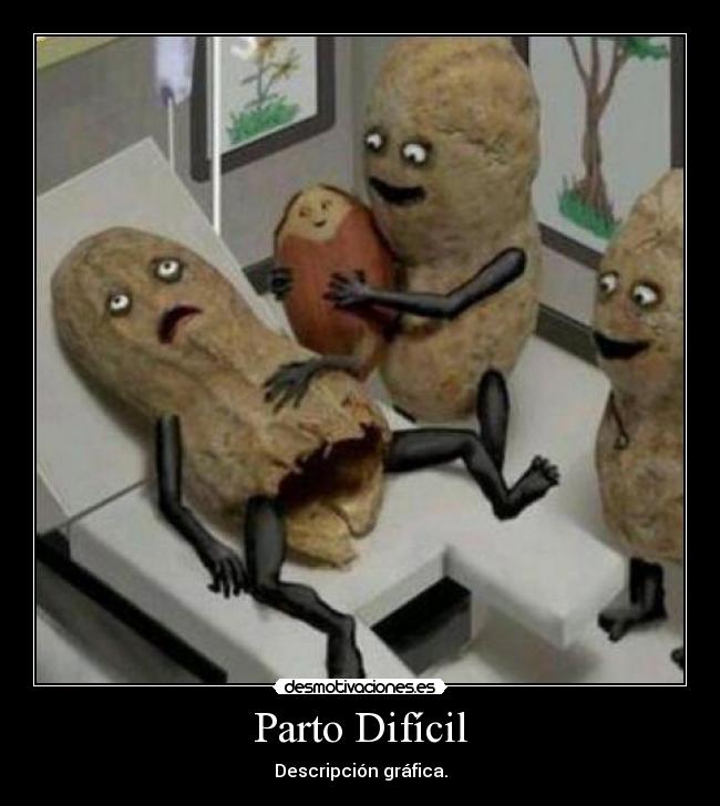 Parto Difícil - Descripción gráfica.