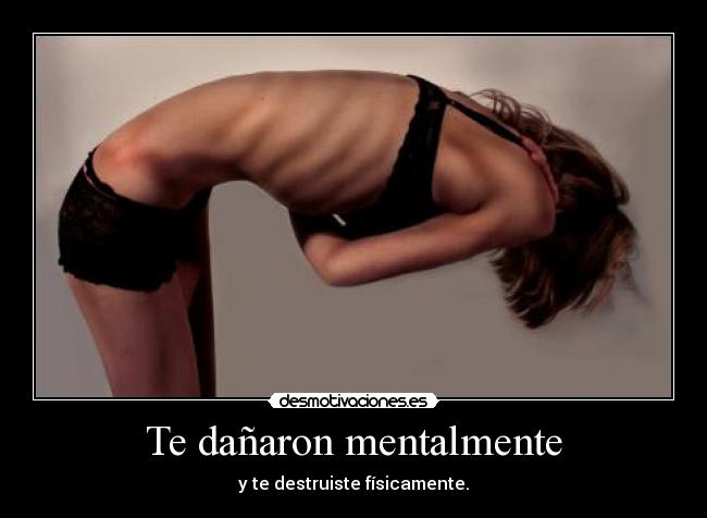 Te dañaron mentalmente -