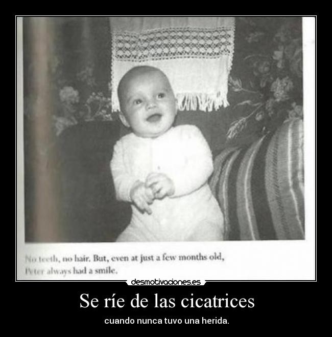 Se ríe de las cicatrices - 