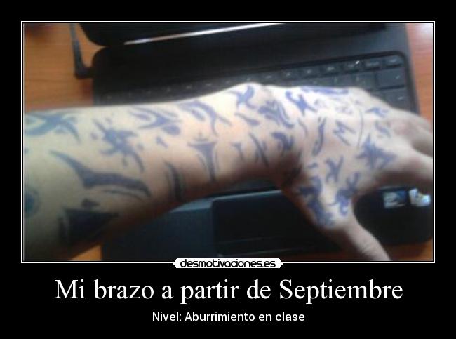Mi brazo a partir de Septiembre - 