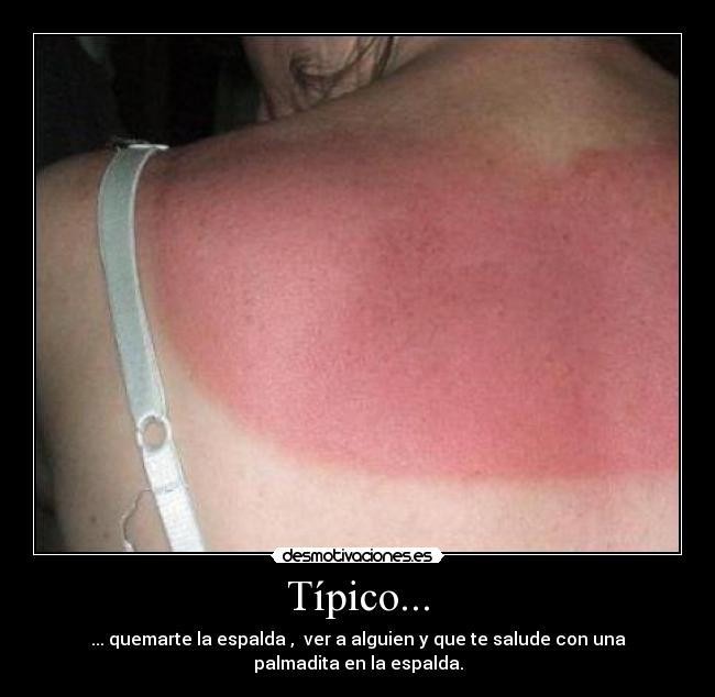 Típico... - ... quemarte la espalda ,  ver a alguien y que te salude con una
palmadita en la espalda.