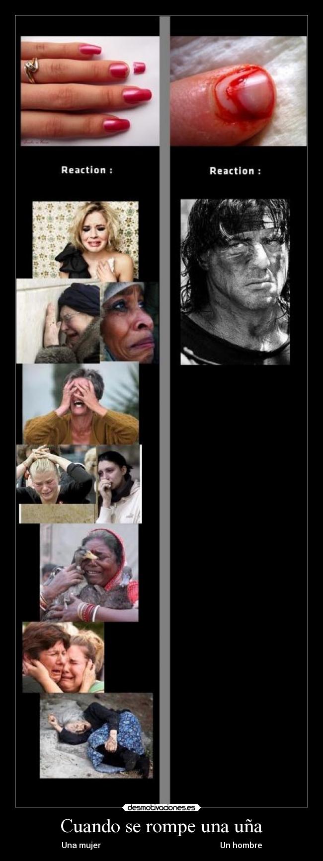 Cuando se rompe una uña -