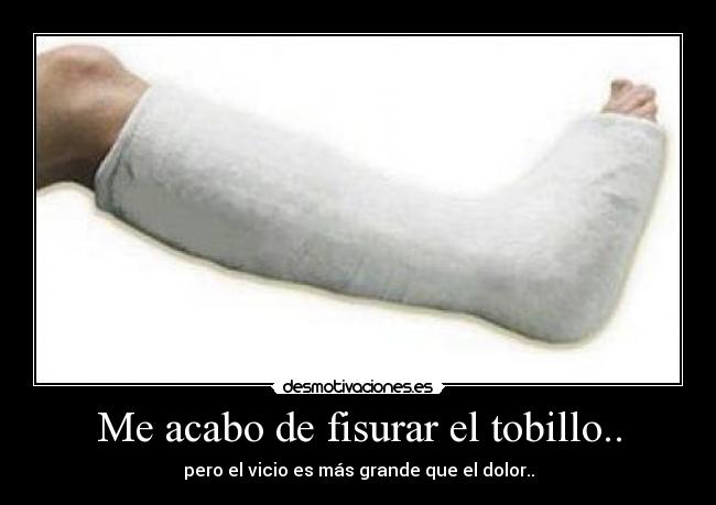 Me acabo de fisurar el tobillo.. - pero el vicio es más grande que el dolor..