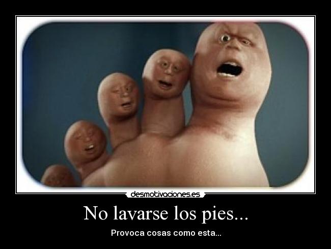 No lavarse los pies... - Provoca cosas como esta...