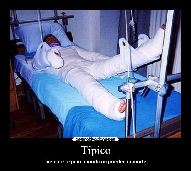 Típico - siempre te pica cuando no puedes rascarte