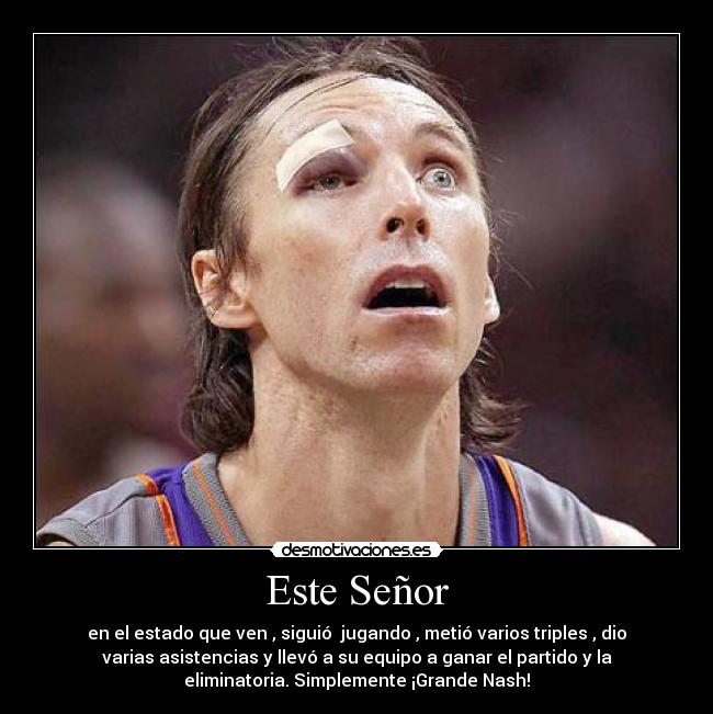Este Señor - en el estado que ven , siguió jugando , metió varios triples , dio
varias asistencias y llevó a su equipo a ganar el partido y la
eliminatoria. Simplemente ¡Grande Nash!