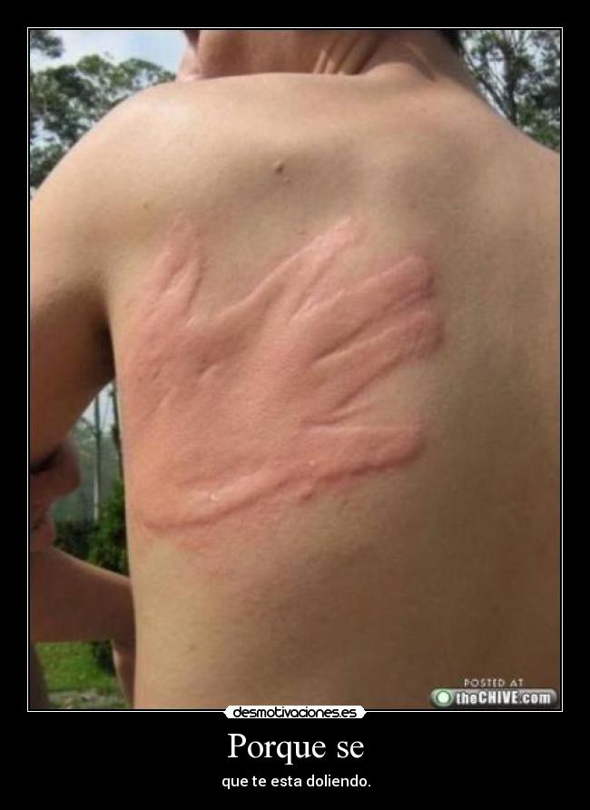 Porque se - que te esta doliendo.