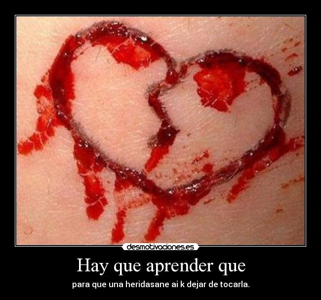 Hay que aprender que - para que una heridasane ai k dejar de tocarla.