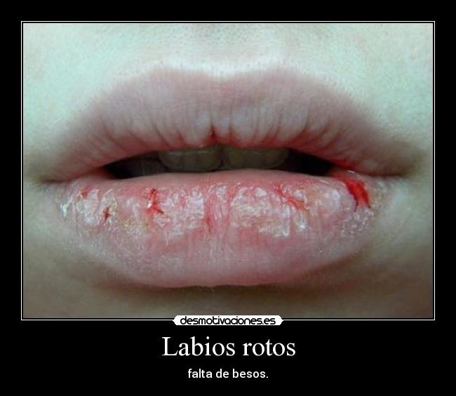 carteles labios rotos desmotivaciones