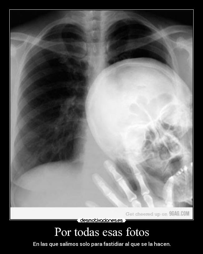 Por todas esas fotos - En las que salimos solo para fastidiar al que se la hacen.
