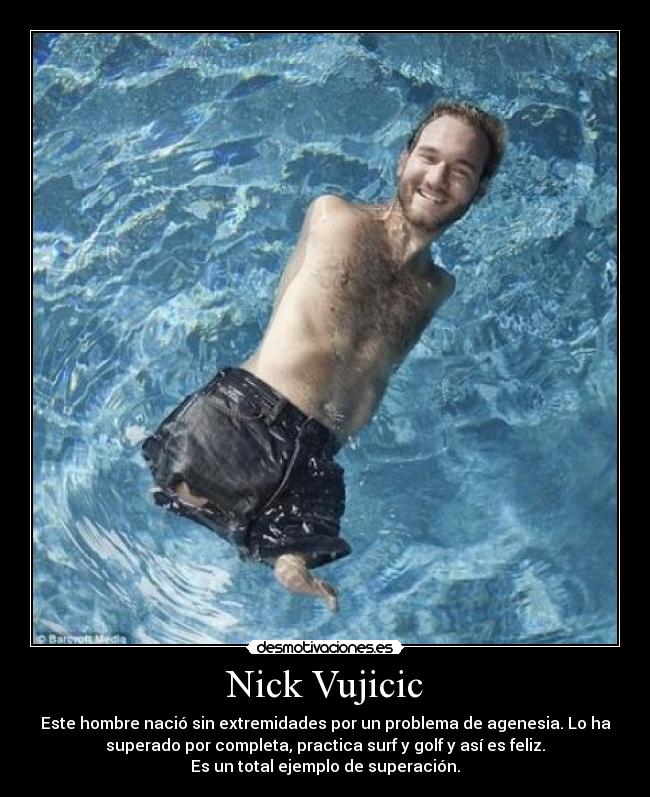 Nick Vujicic - Este hombre nació sin extremidades por un problema de agenesia. Lo ha
superado por completa, practica surf y golf y así es feliz.
Es un total ejemplo de superación.